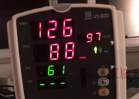 VS800 RESP NIBP SPO2 a employé le moniteur cardiaque de Mindray de moniteur patient